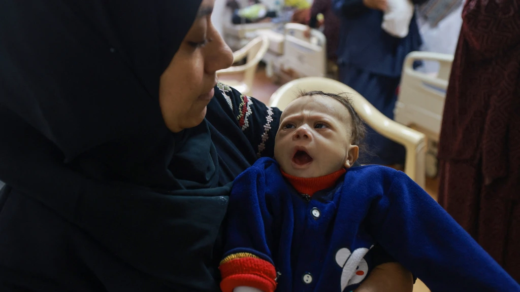 Foto: Baby's in Gaza voor het leven getekend door ondervoeding, situatie nog steeds precair