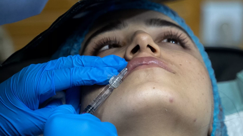 Inspectie waarschuwt voor botox en fillers tijdens introductieweken studenten