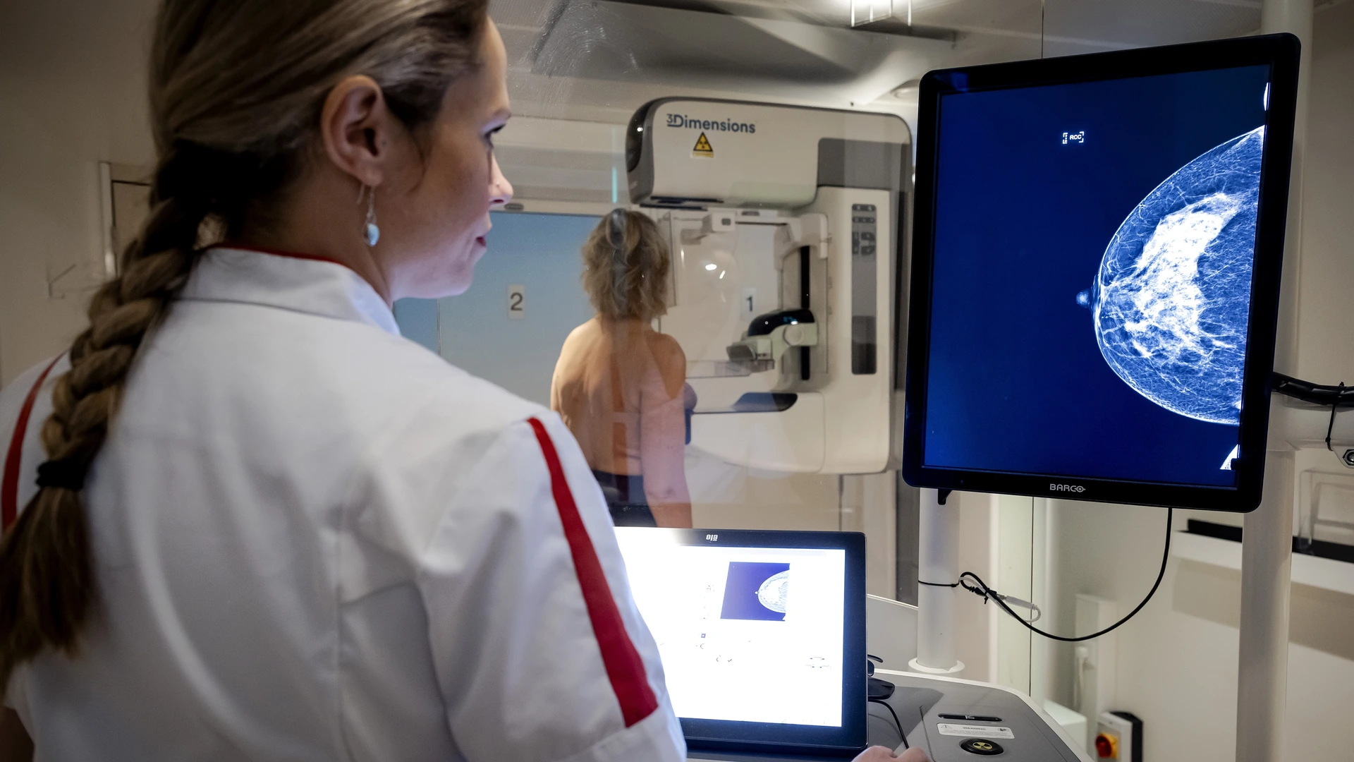 Nieuwe test voor borstkanker kan zorgen voor minder chemotherapie
