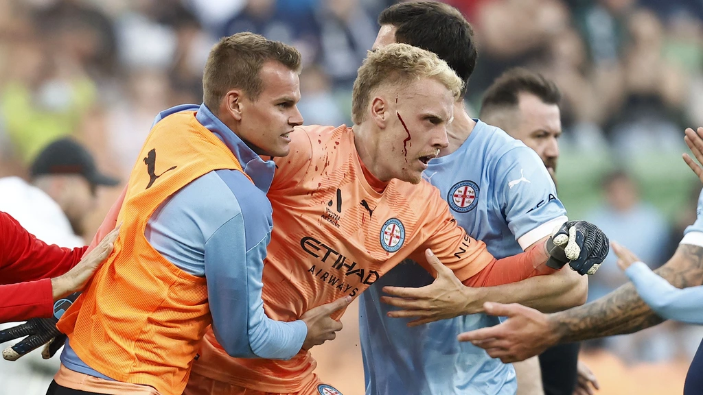 Doelman krijgt metalen bak in het gezicht, voetbalderby in Melbourne ...