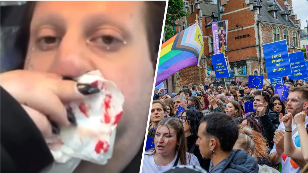 Foto: Artiesten Brussels Pride mishandeld op straat: 'Aangevallen omdat ik homo ben'