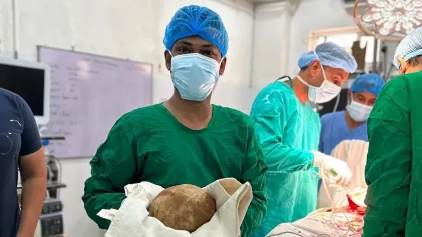Gigantische blaassteen aangetroffen bij Sri Lankaan