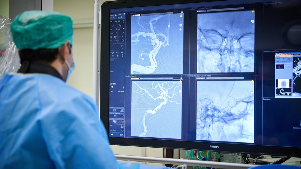 Te weinig neurologen voor de toenemende zorgvraag en behandelmethodes