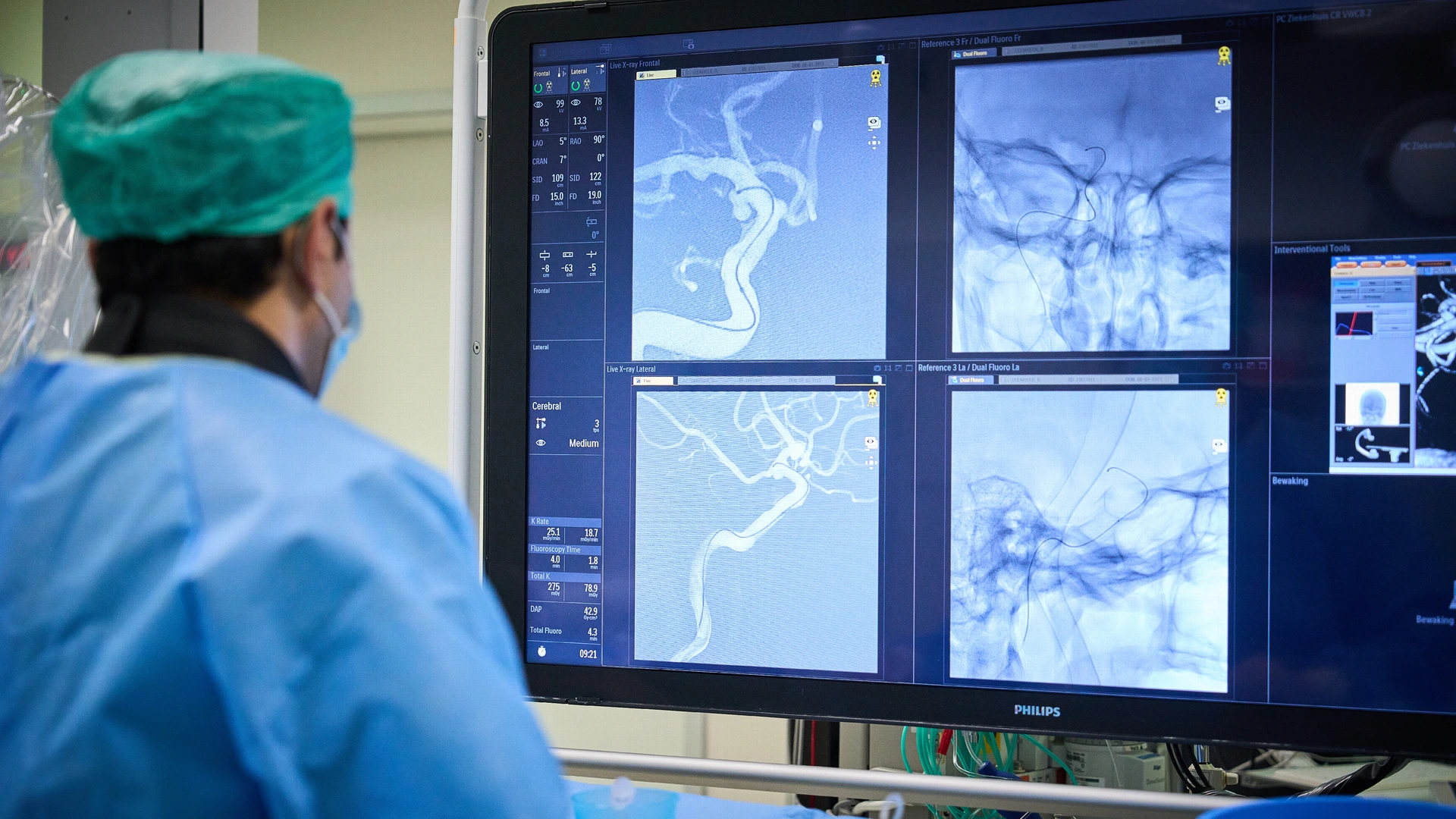 Te weinig neurologen voor de toenemende zorgvraag en behandelmethodes